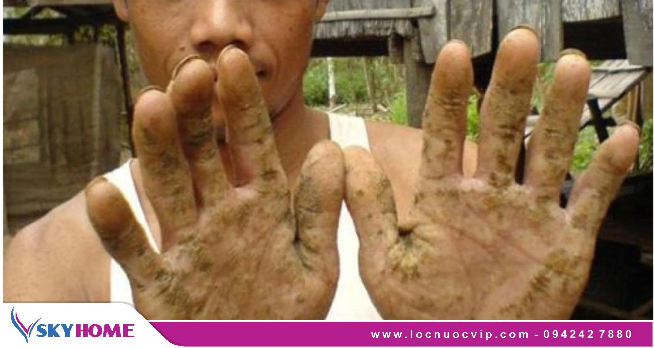 Thạch tín trong nước đã ảnh hưởng đến sức khỏe người dân như thế nào?