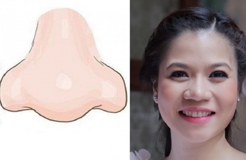 Mũi lân đẹp hay xấu