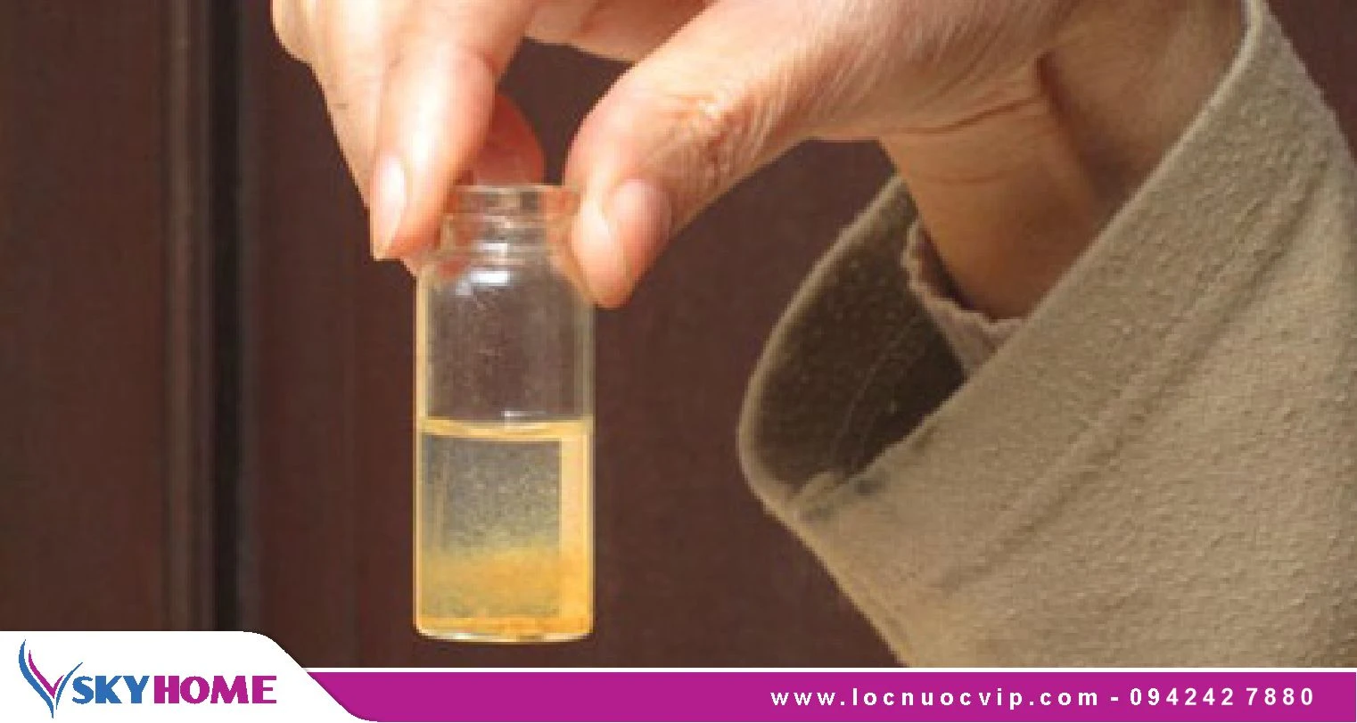 Top 8 nguyên nhân gây ô nhiễm nguồn nước và cách xử lý